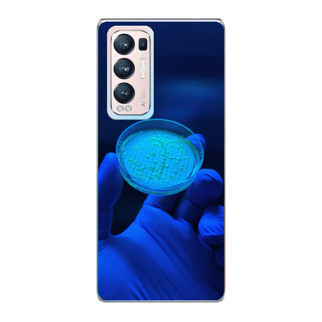 Cover personalizzata Oppo Find X3 Neo